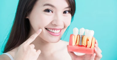 Implantes dentales